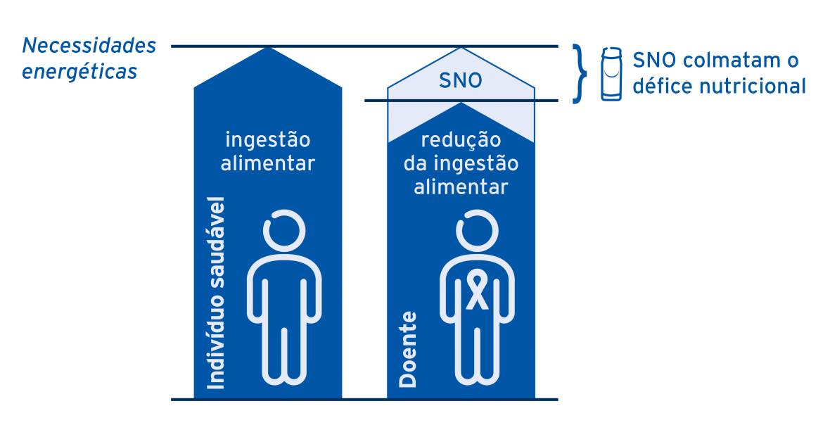 Défice nutricional_oncologia